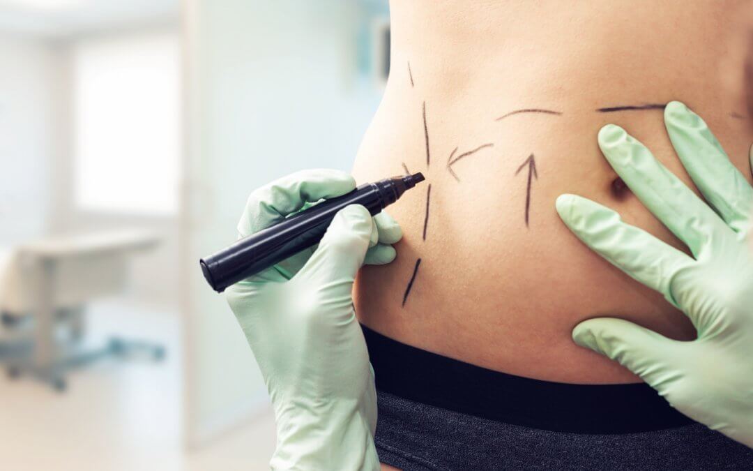 Clínicas de Cirurgia Plástica em Balneário Camboriú